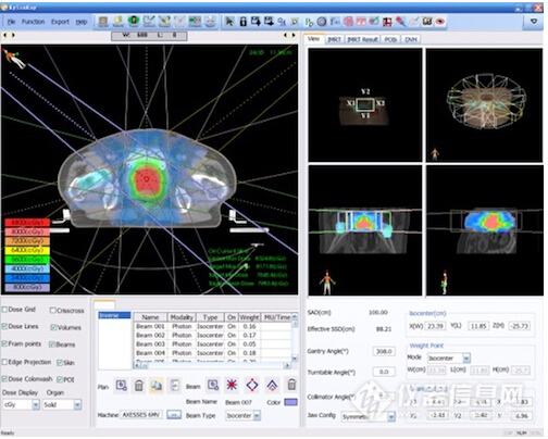 调强[accurate]放射治疗计划系统