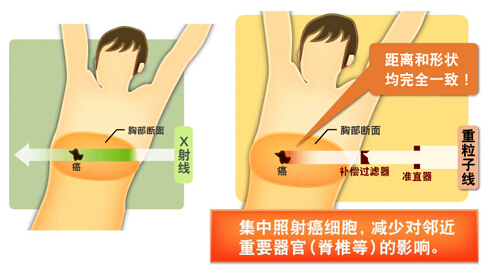 新技术定向治疗示意图