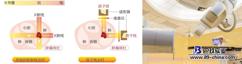 质子重离子治疗癌症示意图